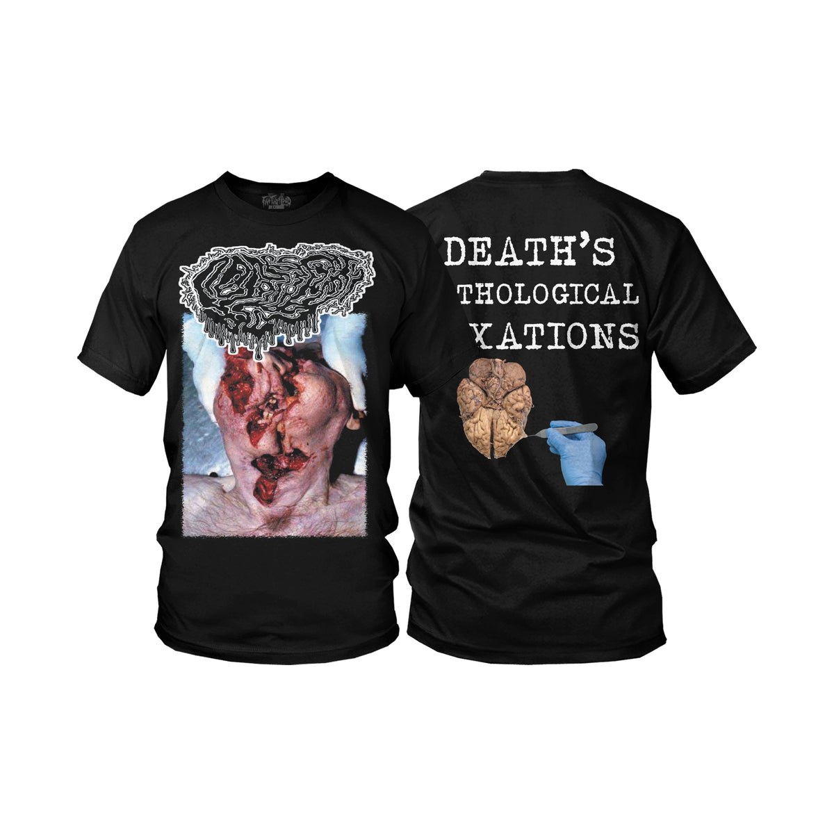 Fetal Deformity "Death Pathological Fixations" T-Shirt