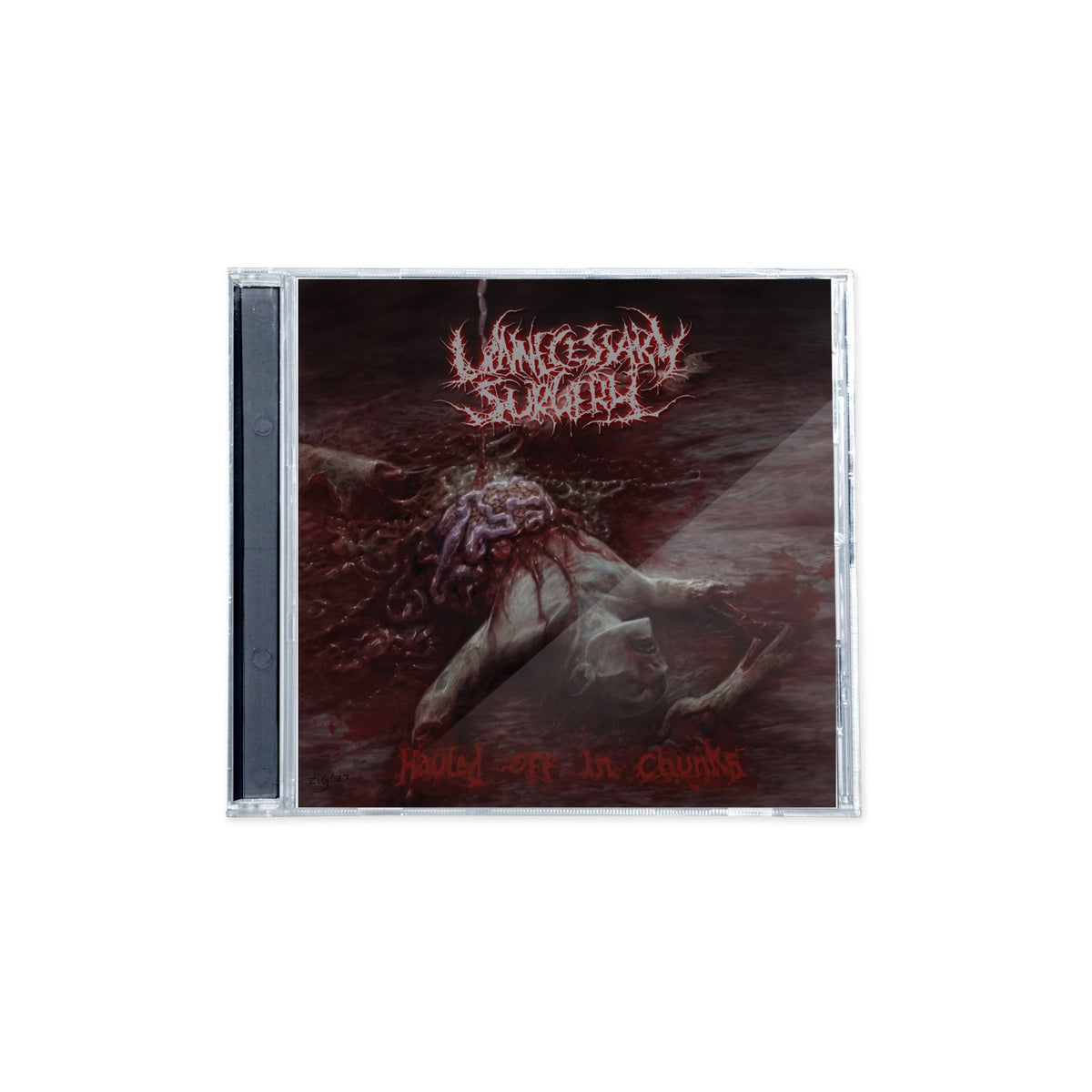 Unnecessary Surgery "Hauled Off in Chunks" CD
