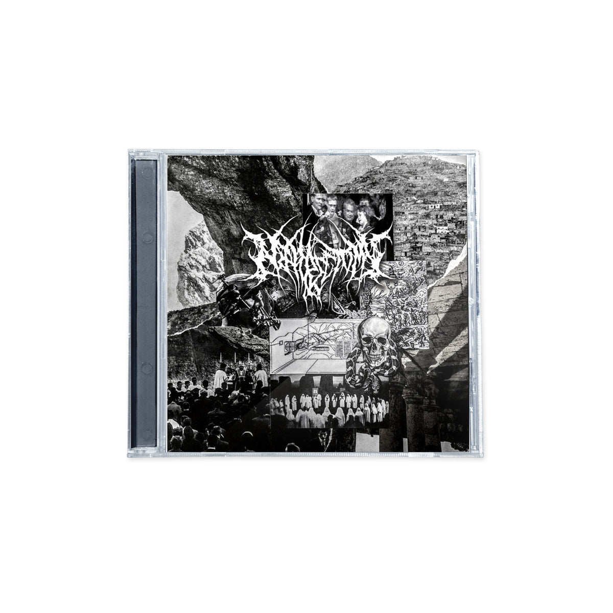 Nephrectomy "El Chapo Gonzo" CD