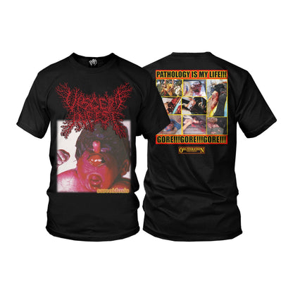 Viscera Infest "Sarcoidosis" T-Shirt