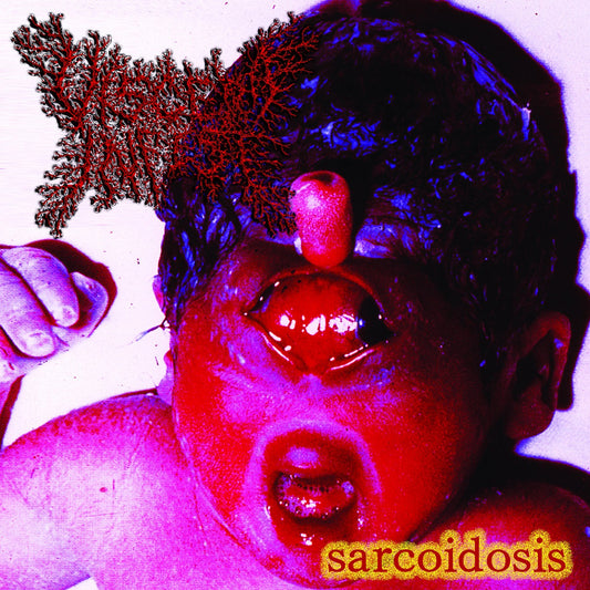 Viscera Infest "Sarcoidosis" 12"