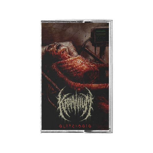 Kraanium "Slamchosis" Cassette