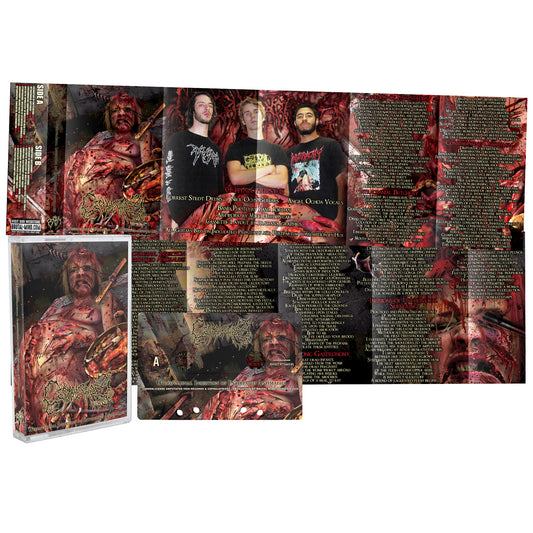 Cephalotripsy "Uterovaginal Insertion of Extirpated Anomalies	" Cassette